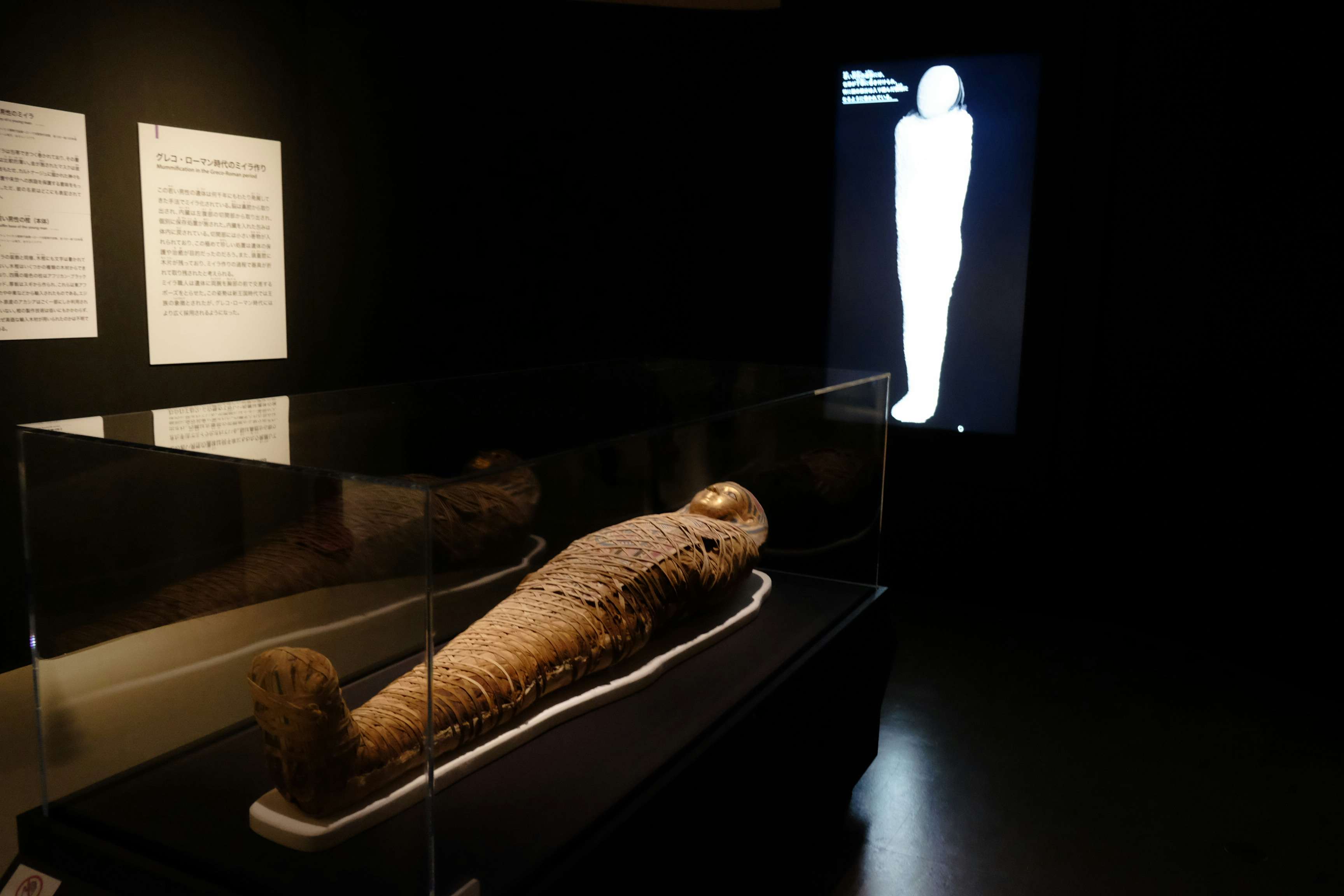 6体のミイラをctスキャンで解析 古代エジプト人の生き様を知る 大英博物館ミイラ展 古代エジプト6つの物語 が開幕 画像ギャラリー 30 35 美術手帖