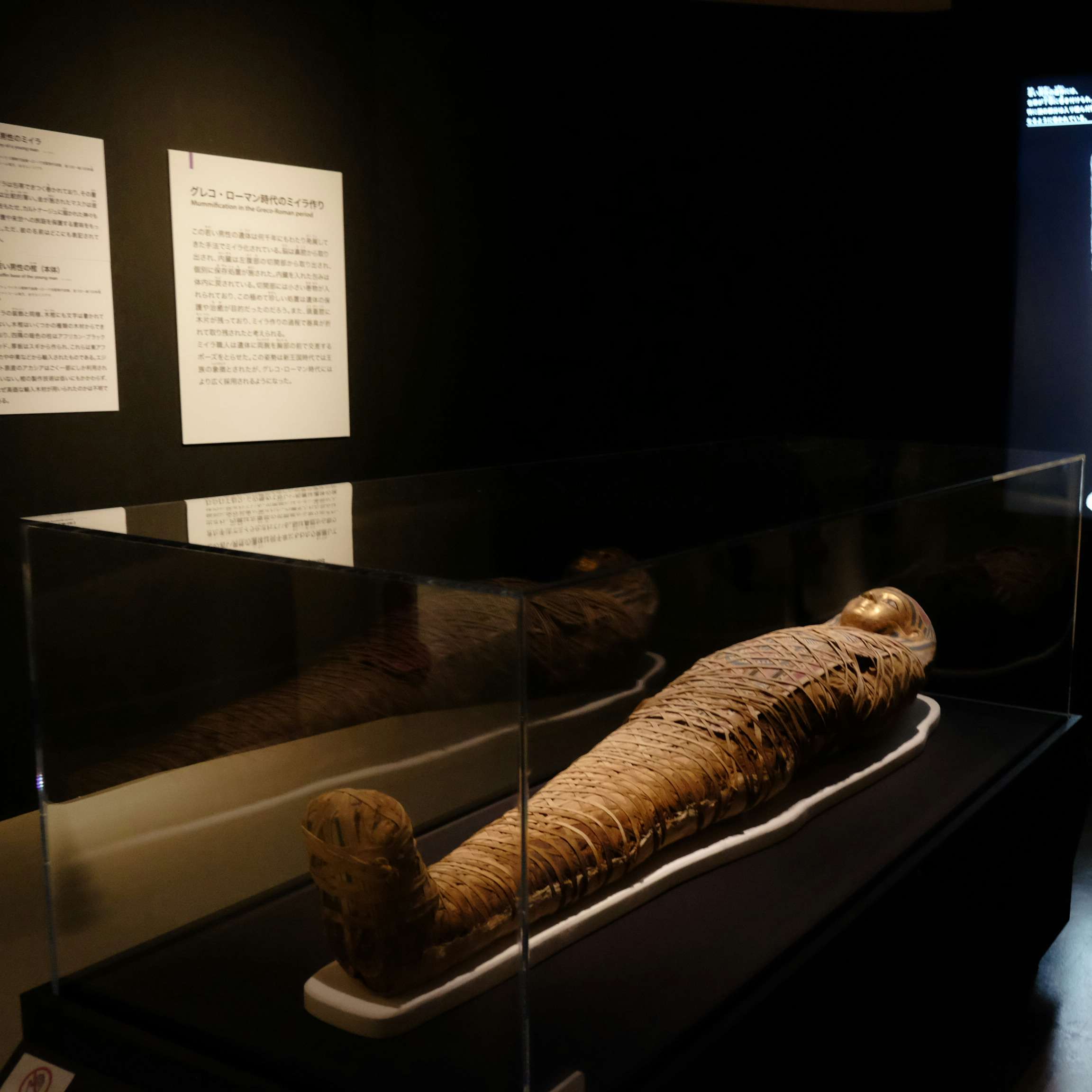 6体のミイラをctスキャンで解析 古代エジプト人の生き様を知る 大英博物館ミイラ展 古代エジプト6つの物語 が開幕 画像ギャラリー 30 35 美術手帖 6体のミイラをctスキャンで解析 古代エジプト人の生き様を知る 大英博物館ミイラ展 古代エジプト6つの物語 が開幕 画像ギャラリー 30 35 美術手帖